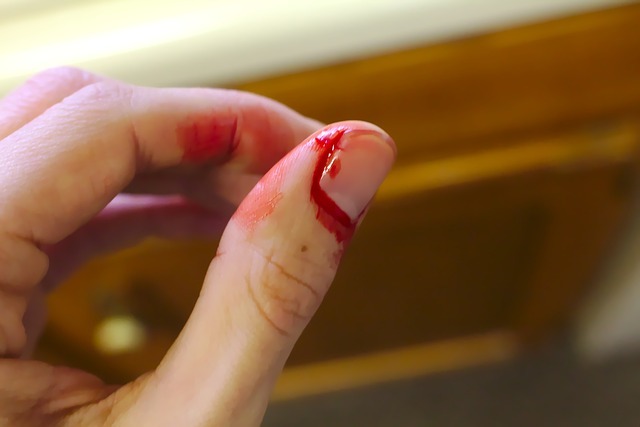Accident, Bleed, Bleeding, Bleeding Finger, Blood, Sink